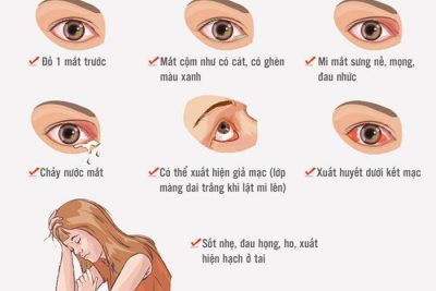 BÀI TUYÊN TRUYỀN  “VỀ CÁCH PHÒNG BỆNH ĐAU MẮT ĐỎ”